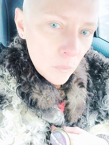 Customer photo review of [US Warehouse] Topaz Prescription Contact Lenses