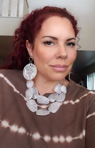 Customer photo review of Neala Green Contact Lenses(12 months wear)