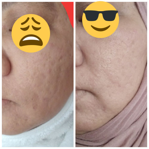 Customer photo review of Teamon scar set