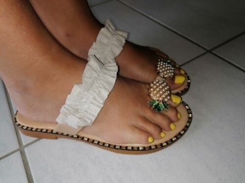 Customer photo review of Kafa™ Cute Pineapple Sandals【FREE SHIPPING】