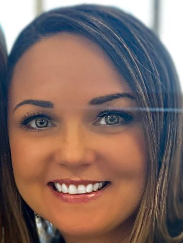 Customer photo review of Eyra Blue Contact Lenses(12 months wear)