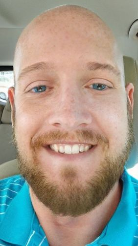 Customer photo review of [US Warehouse] Egypt Blue Precription Contact Lenses