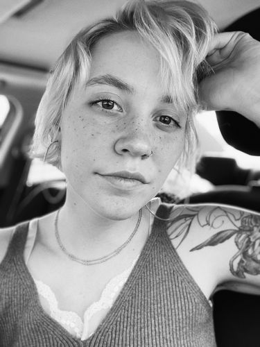 Customer photo review of Freckle Stain