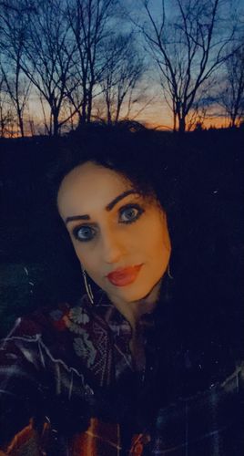 Customer photo review of Nanee Blue Contact Lenses(12 months wear)