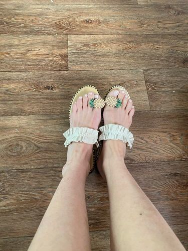 Customer photo review of Kafa™ Cute Pineapple Sandals【FREE SHIPPING】