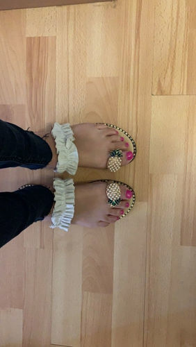 Customer photo review of Kafa™ Cute Pineapple Sandals【FREE SHIPPING】