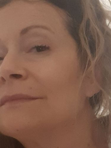 Customer photo review of Acido Ialuronico Puro - Idratante, Rimpolpante, Antirughe, 30ml