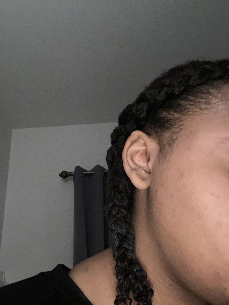 Customer photo review of Original Jamaican Black Castor Oil Growth Serum
