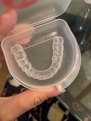 Customer photo review of Night Guard