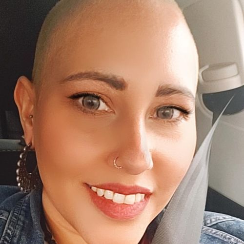 Customer photo review of Citha Gray Contact Lenses(12 months wear)