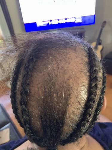 Customer photo review of Nae Nae's 9oz Hair Boost Special