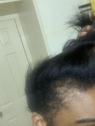Customer photo review of Nae Nae's 9oz Hair Boost Special