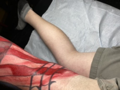 Customer photo review of Signature Tattoo Numbing Cream
