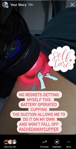 Customer photo review of Achedaway Cupper - The Smart Cupping Therapy Massager