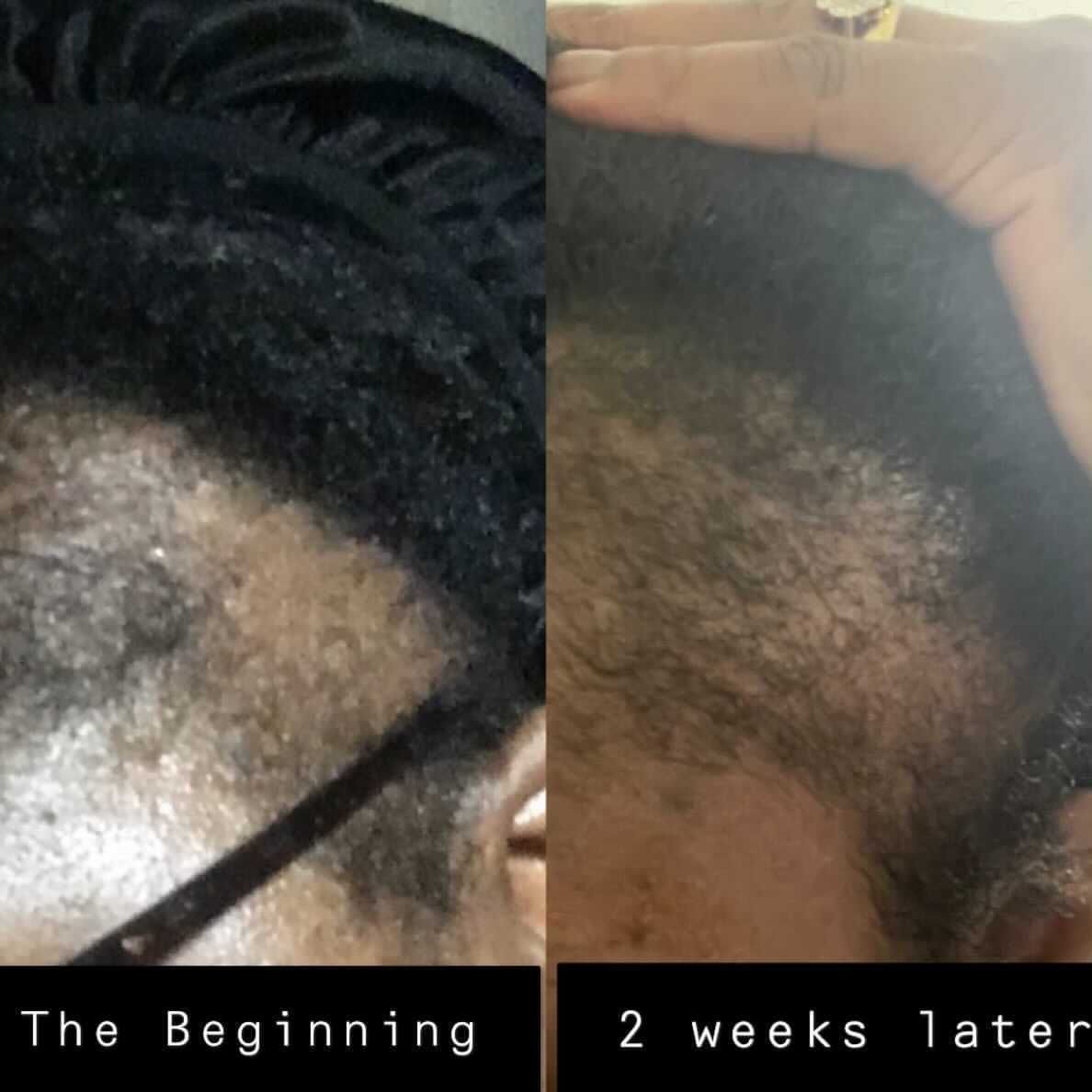 Customer photo review of The Staple Remedy Herbal Growth Oil