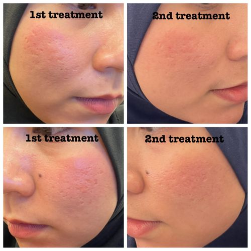Customer photo review of Happiness box - Scar + Treatment set
