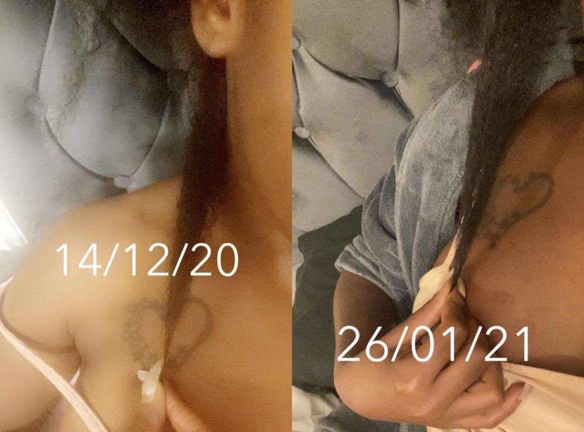 Customer photo review of The Staple Remedy Herbal Growth Oil