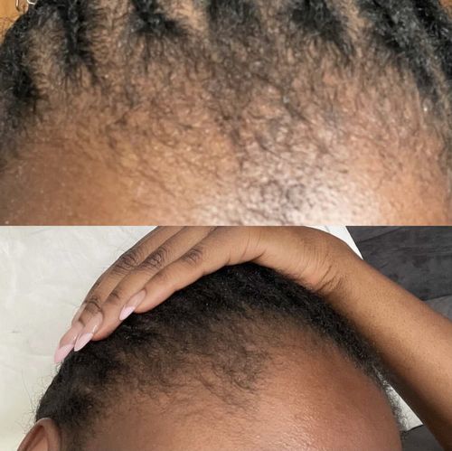 Customer photo review of Genesis