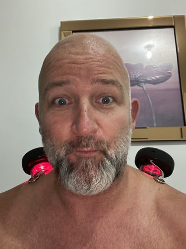 Customer photo review of Achedaway Cupper - The Smart Cupping Therapy Massager