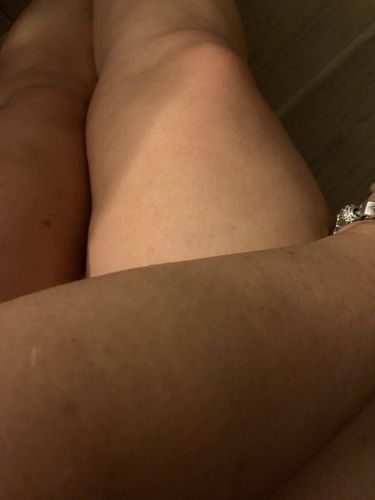 Customer photo review of Beginner Glow Bundle