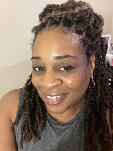 Customer photo review of Fair and White Original Brightening Serum 30 ml / 1 fl oz