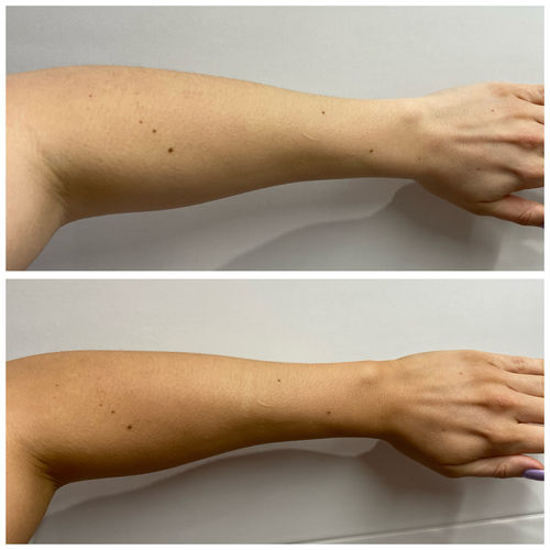 Customer photo review of Kit bronzage