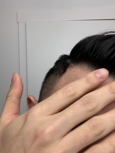 Customer photo review of Serum Concentrate Kit