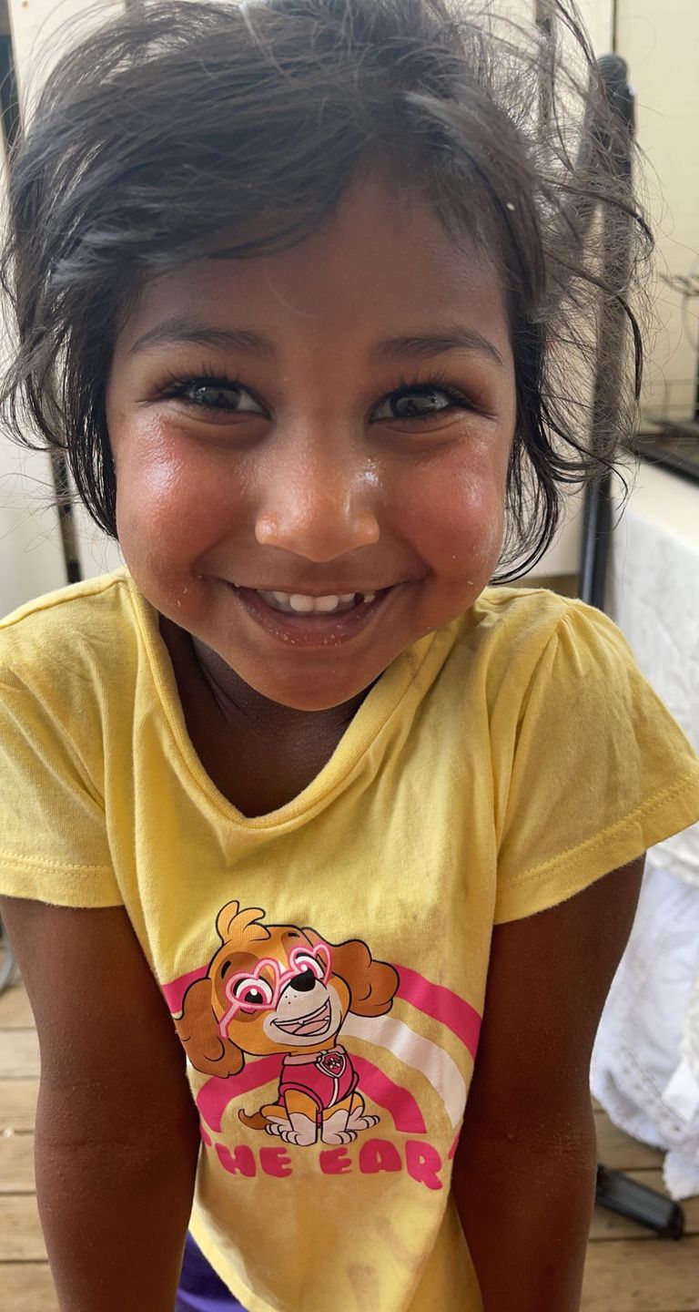 Customer photo review of Eczema Saviour