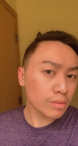 Customer photo review of Serum Concentrate Kit