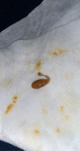 Customer photo review of Easter Bundle (2 Ear Cleaners + 2 Replacement Tip Kits) $120 Value