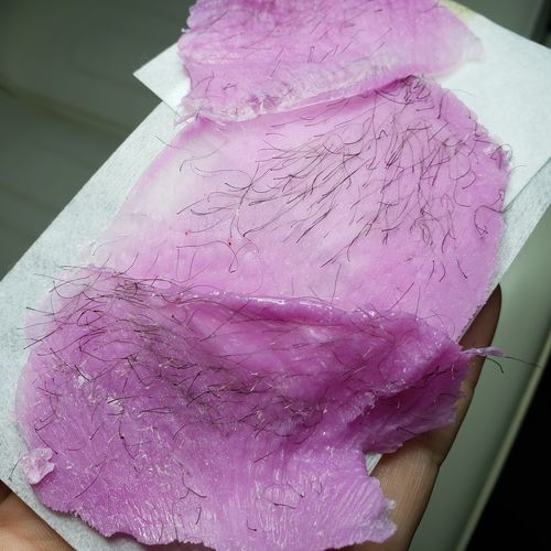 Customer photo review of Signature Series Hair Removal Wax
