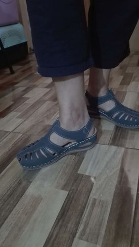 Customer photo review of Kafa™ Summer Comfort Wedge Sandals
