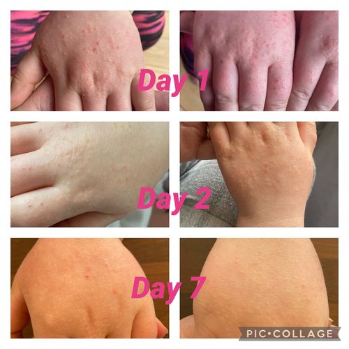 Customer photo review of Family Remedy Cream 100ml