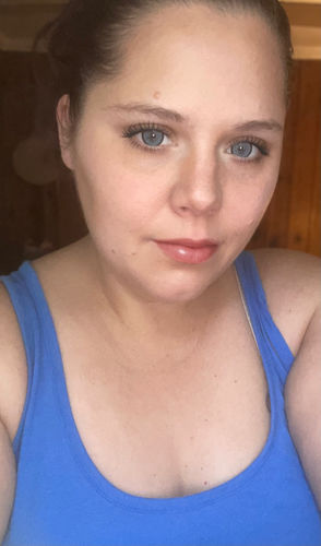 Customer photo review of Norko Blue Contact Lenses(12 months wear)