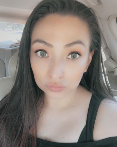 Customer photo review of Quartz Prescription Contact Lenses