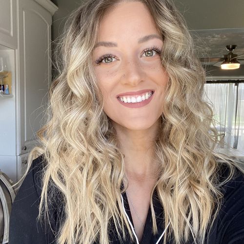 Customer photo review of Freckle Stain