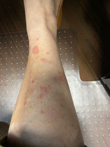 Customer photo review of Intensive Night Balm