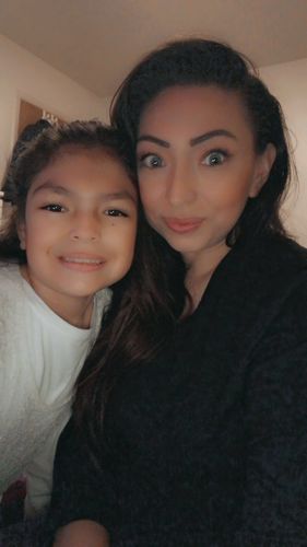 Customer photo review of Topaz Prescription Contact Lenses