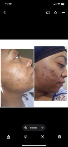 Customer photo review of 3 Pack Hair & Skin Smoothie