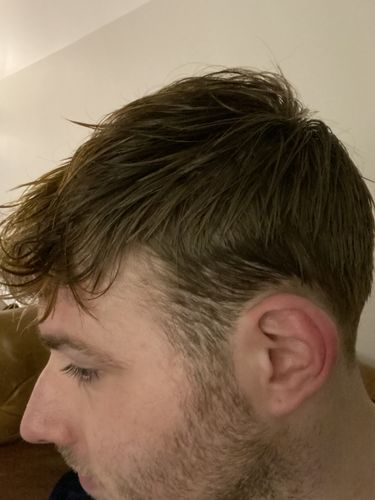 Customer photo review of Serum Concentrate Kit