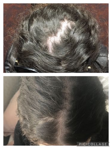 Customer photo review of Growth & Shine Hair Oil