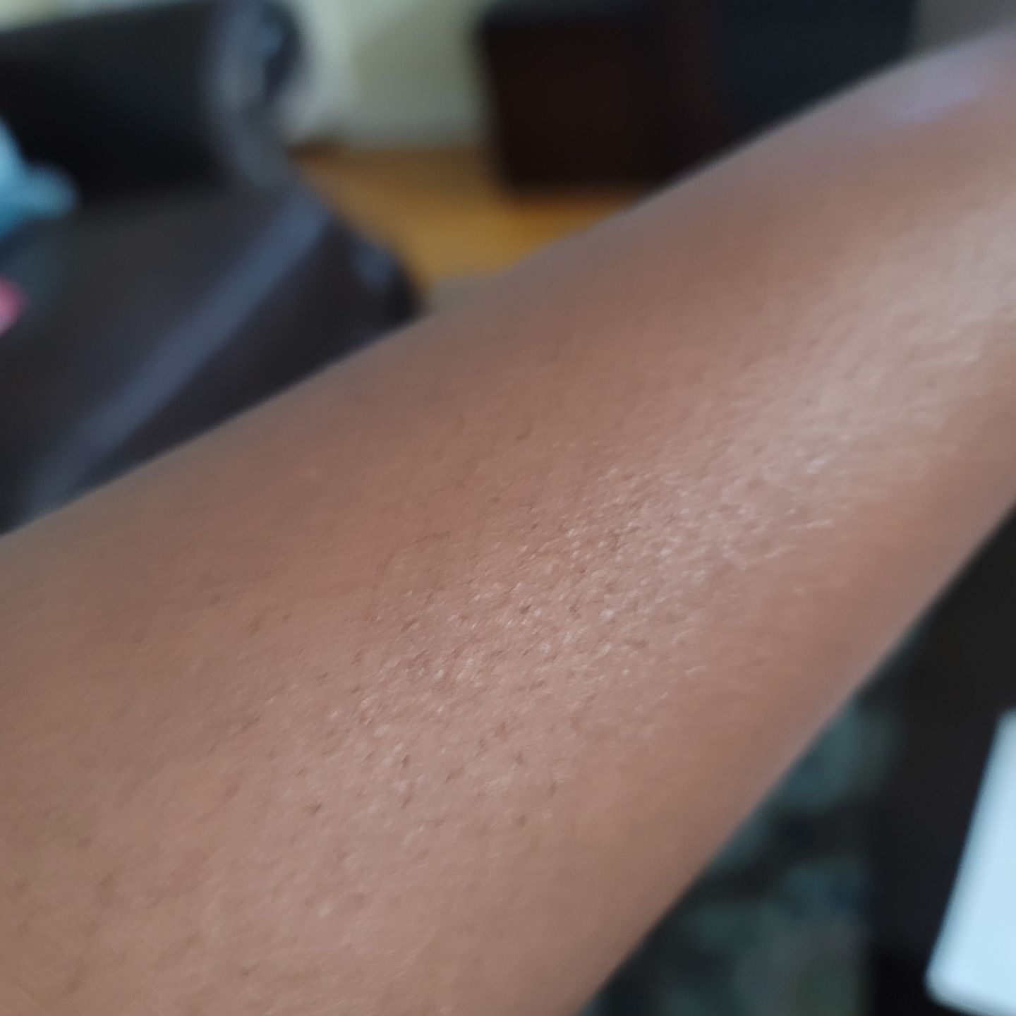 Customer photo review of Fair and White So White Skin Perfector Purifying Cream 250ml / 8.4 fl oz