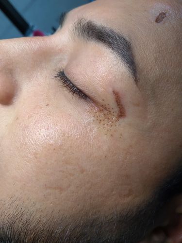 Customer photo review of Fibroblast Online Training