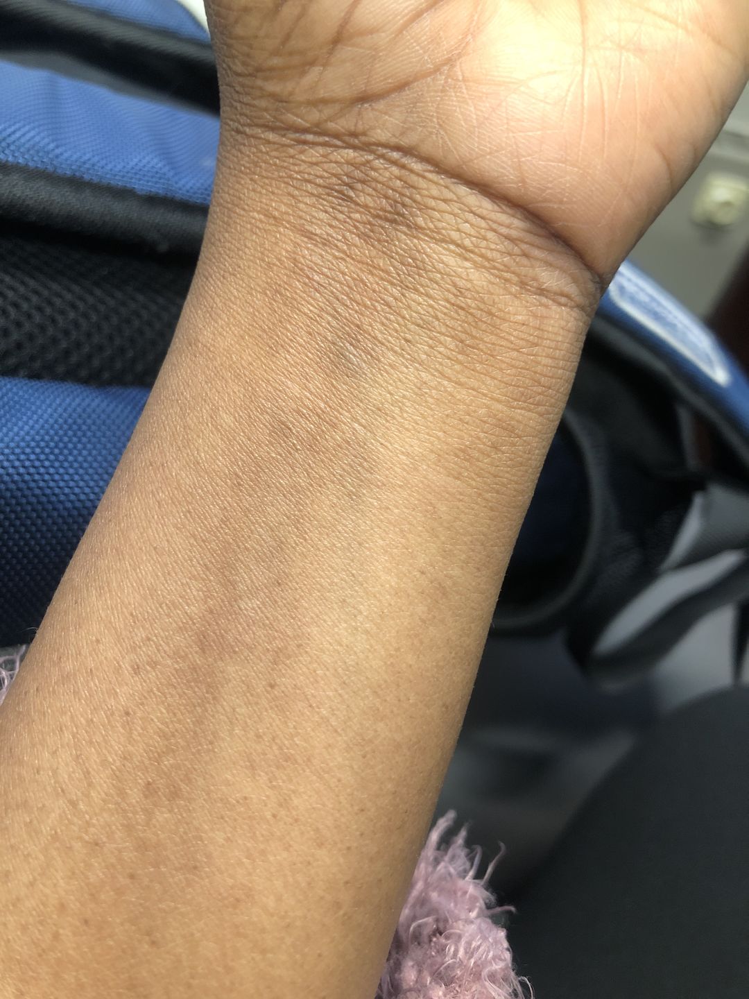Customer photo review of Fair and White Glutathion Extra Serum Anti-Dark Spot 30ml / 1.01 Fl Oz