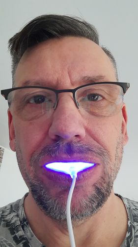 Customer photo review of SmileSecret Oster Special