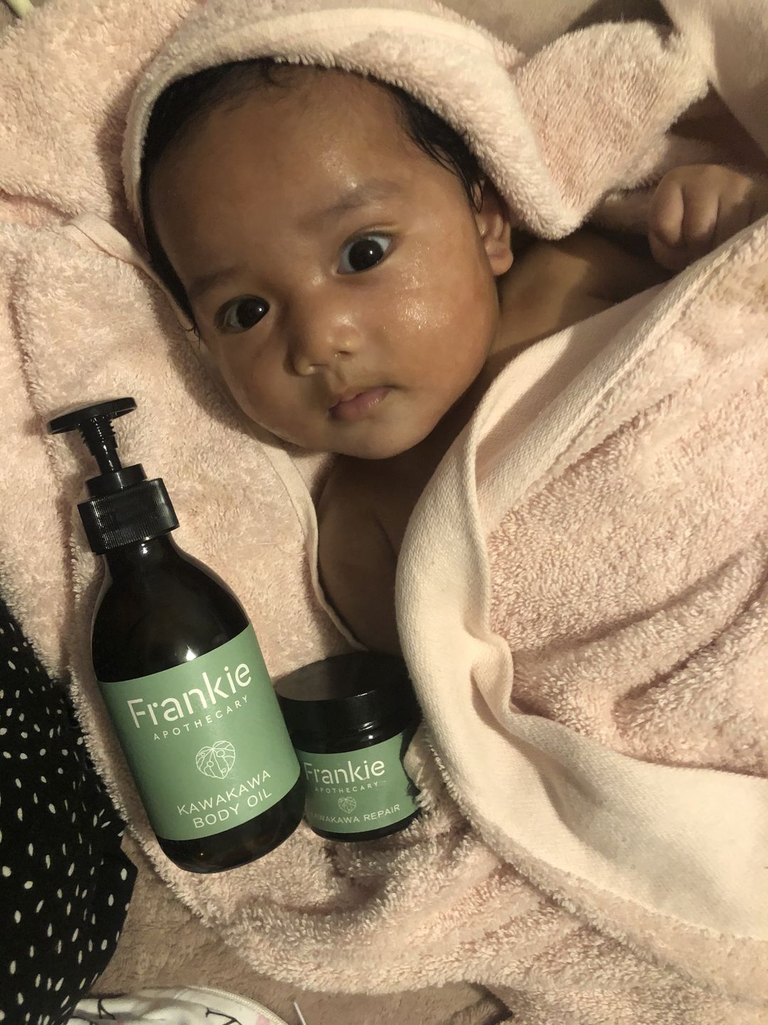 Customer photo review of Eczema Saviour