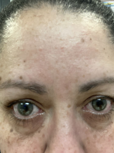 Customer photo review of SL29 Green Contact Lenses(12 months wear)