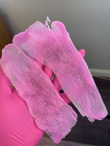 Customer photo review of Signature Series Hair Removal Wax