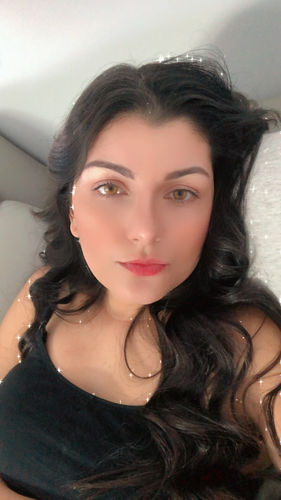 Customer photo review of SL29 Brown Contact Lenses(12 months wear)
