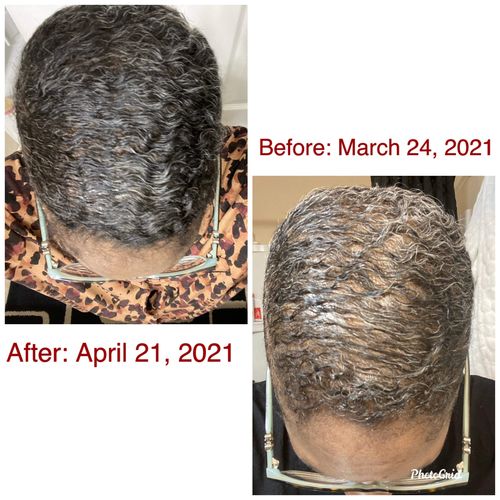 Customer photo review of BEST SELLER! Chad and India’s Root to Tip Bundle| 3 sizes to choose from